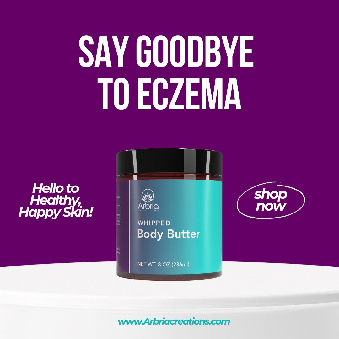Flyer with whipped body butter say goodbye to eczema
